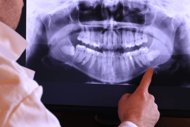 Best Emergency Dentist for Knocked-Out Tooth in Foscoe, NC